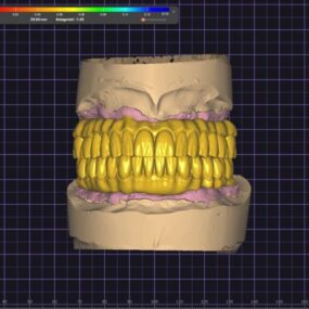 bursa diş protez laboratuvarı