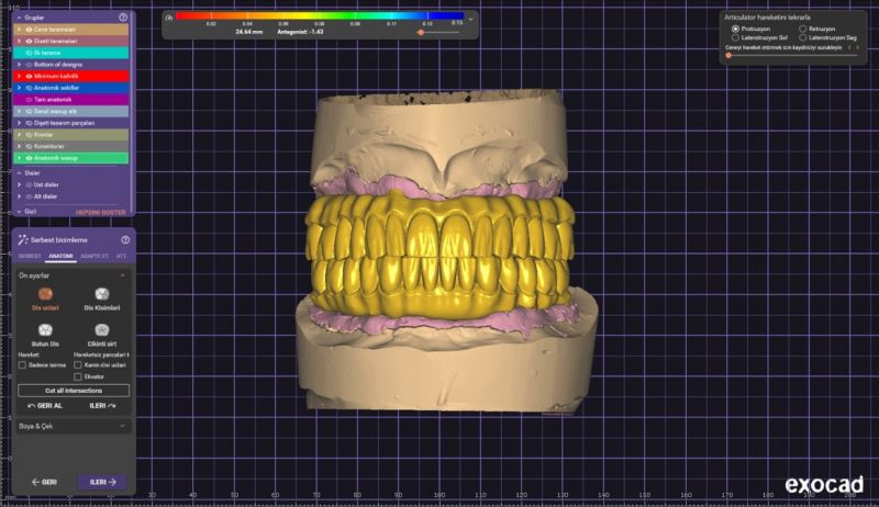 bursa diş protez laboratuvarı