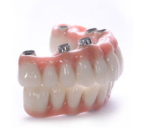 implant üstü tasarım