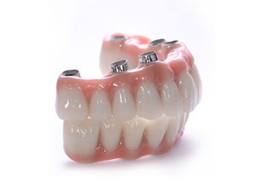 implant üstü tasarım