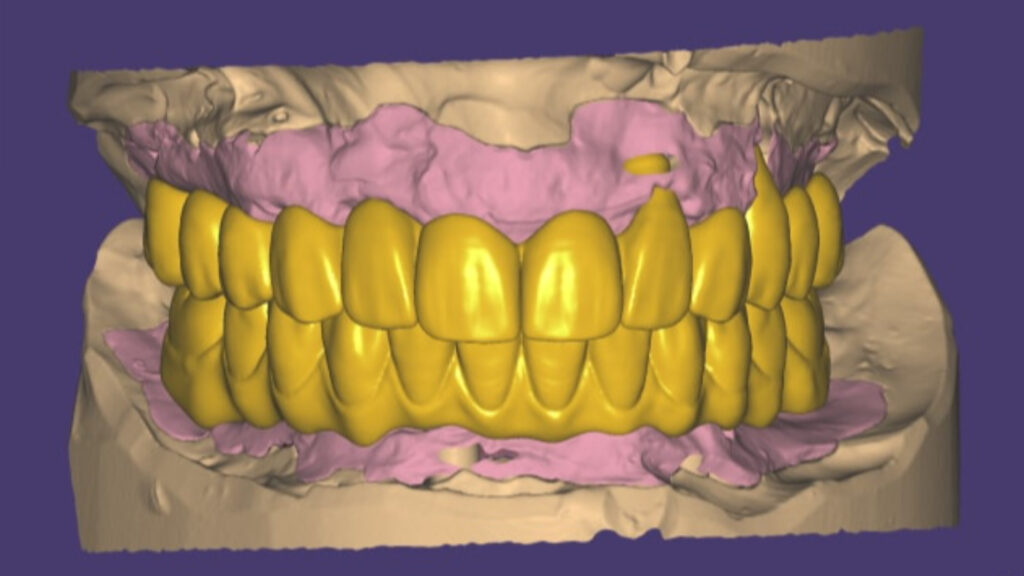 exocad programı Exocad Programı