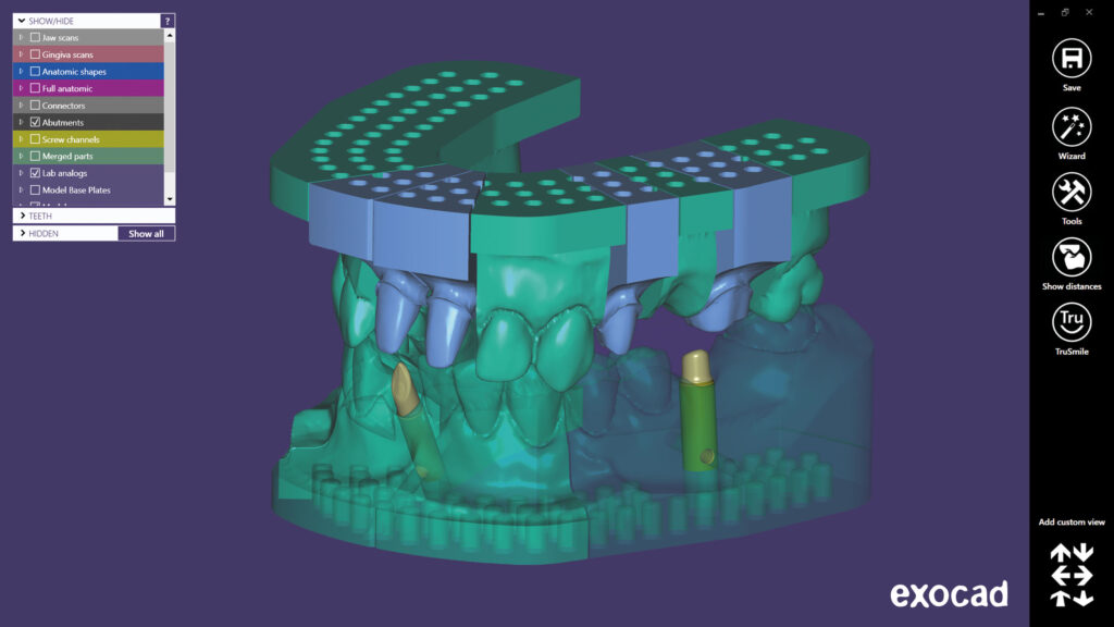 uzaktan exocad kursu